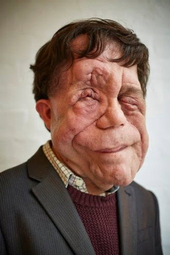 Ảnh của Adam Pearson